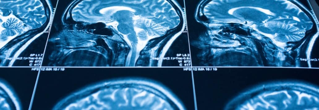 image of scanned brains