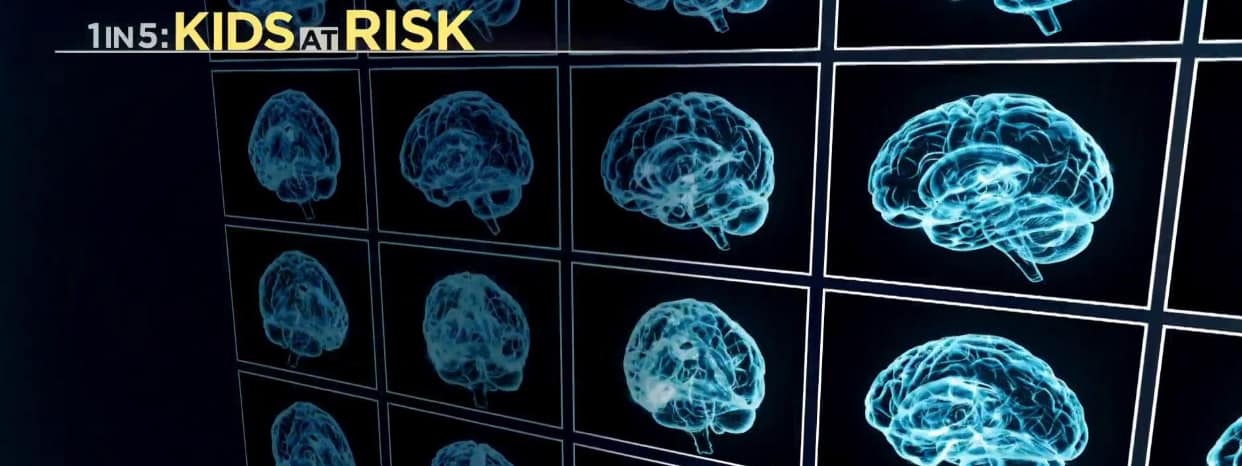 image of multiple brain scans