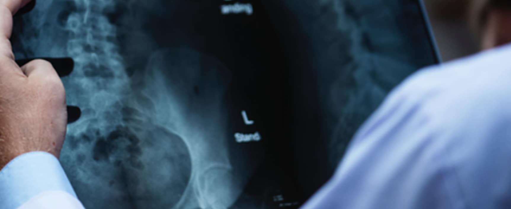 Medical professional looking at an X-ray of a spine