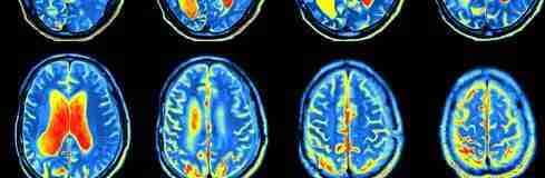 brain scan images