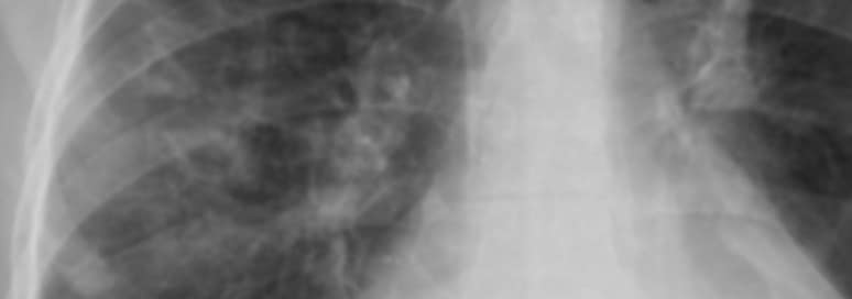 X-ray image
