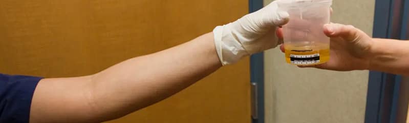 urine drug screen