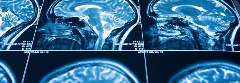 image of scanned brains