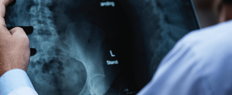 Medical professional looking at an X-ray of a spine