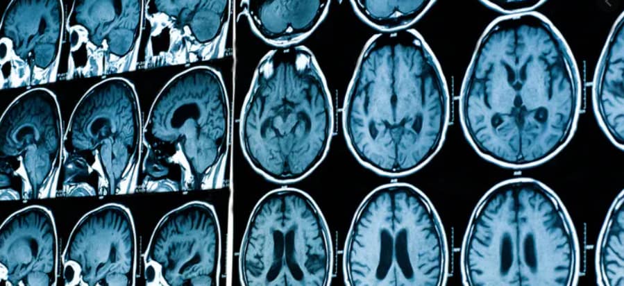 Brain scans