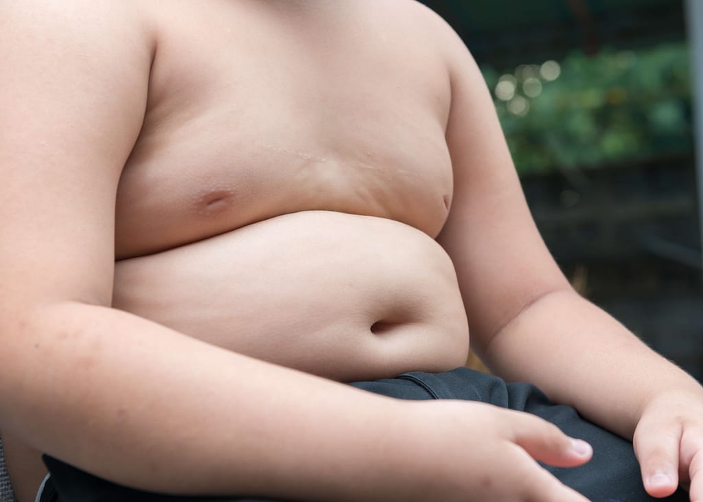 obese child