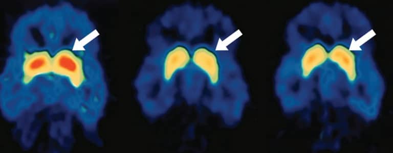 image of brain scans